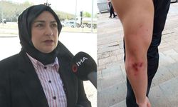 Ankara'da 14 Yaşındaki Çocuğa Öldüresiye 'Darp' İddiası