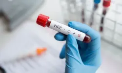 Türkiye’de HIV Gerçeği: 10 Yılda Yüzde 460 Arttı