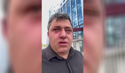 Altındağ Belediye Başkanı Tiryaki Hakkında Darp İddiası