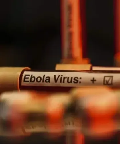 DSÖ'den Korkutan Ebola Açıklaması: Kontrol Edemiyoruz