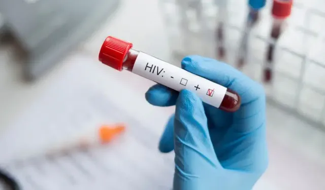 Dünyada Düştü Türkiye'de Arttı: HIV Vakaları Kadınlarda Fırladı