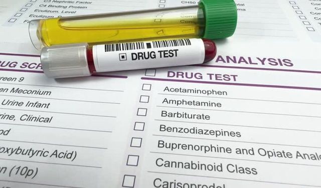 İşe Alımda Uyuşturucu Testi Dönemi