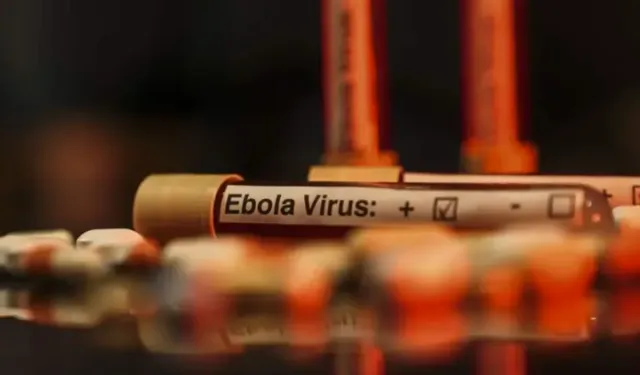 DSÖ'den Korkutan Ebola Açıklaması: Kontrol Edemiyoruz